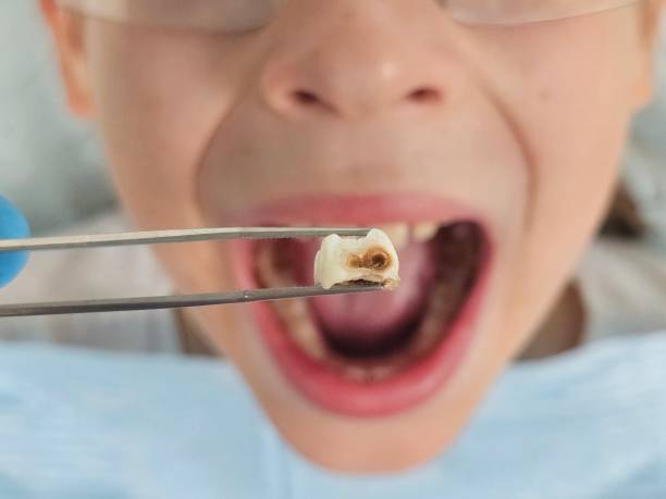 Best Emergency Pediatric Dentist  in Kensington, MD